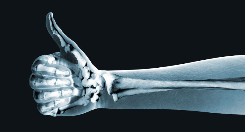 A X ray of a hand showing a thumbs up. It's intended to be lighthearted on a page about personal injury.